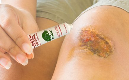 AMERIGEL Hydrogel Wound Dressing Application-SQ